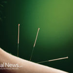 Tailored Acupuncture May Reduce Pain Intensity for Chronic Pain Sufferers (Fibromyalgia)