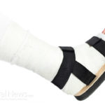How to Rehabilitate a Sprained Ankle?