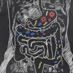 Healing the Gut–will new AI technology make your MD obsolete?