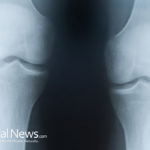 How Knee Pain Can Be Brought under Control: Natural Remedy