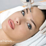Five Side Effects of Botox