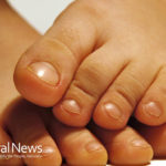 Ingrown toenail: You big toe’s worst enemy