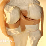 Knee Implant Industry Throws Patients Under the Bus In Rush For Profits