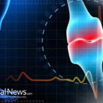 Osteoporosis – bone strength matters
