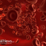 What causes blood clots and what are some symptoms?