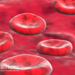 Anemia – Red blood cell’s enemy