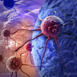 Methionine Restriction for Cancer: Is It Right for You? 